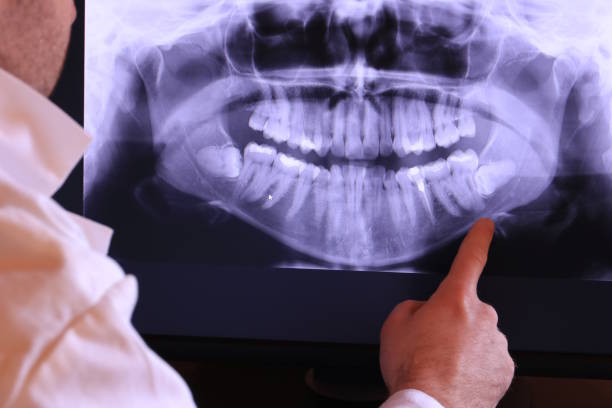 Best Emergency Treatment for Dental Infections or Abscesses in Rector, AR